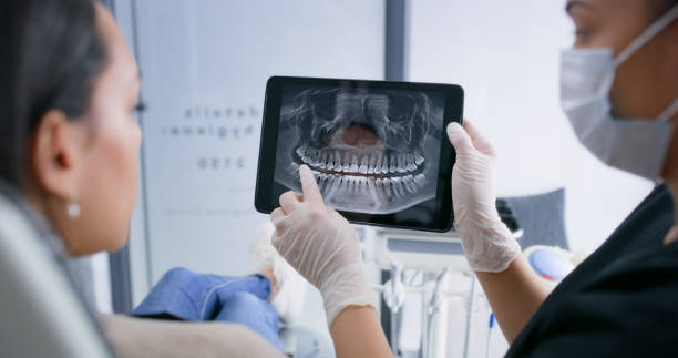 Licensed Dental Implants service in Roswell, GA - Smile Center Dentistry